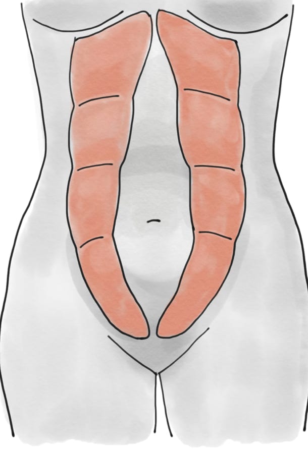 Rektusdiastase, Rückbildung, rektusdiastase rückbildung, rektusdiastase schliessen, kostenlose rückbildung, rückbildung kostenlos, rektusdiastaseübungen, rektusdiastase bauch, flacher bauch, flacher bauch übungen, flachen bauch bekommen,